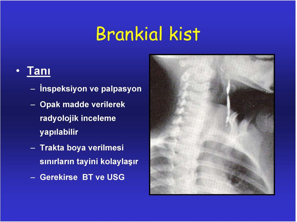 inceleme yapılabilir Trakta boya