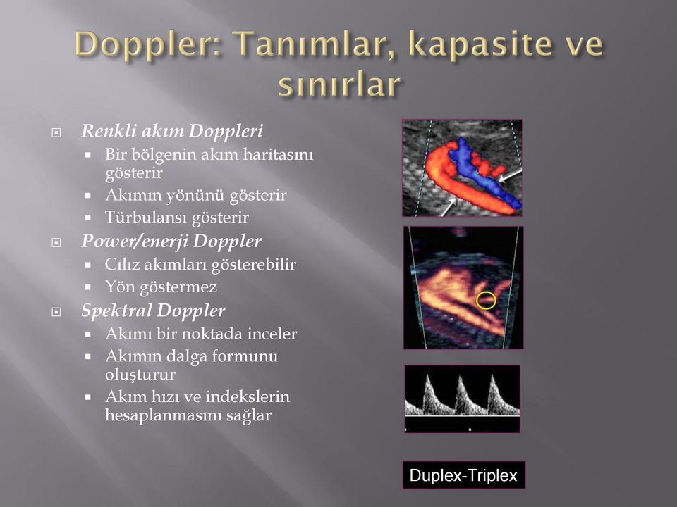 gösterebilir Yön göstermez Spektral Doppler Akımı bir noktada inceler