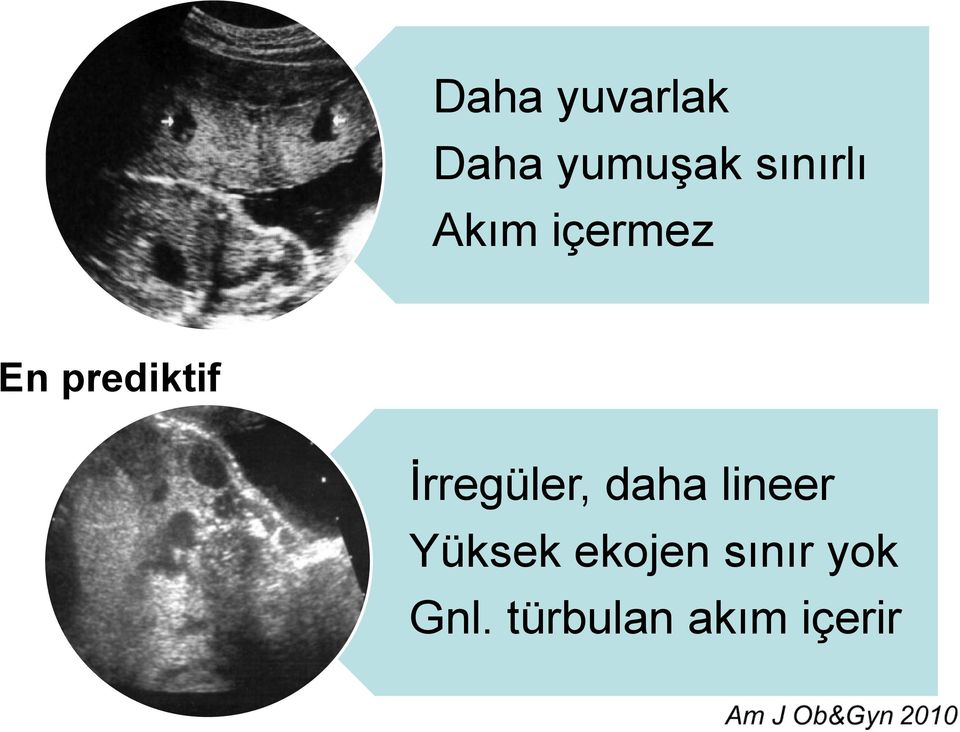 İrregüler, daha lineer Yüksek