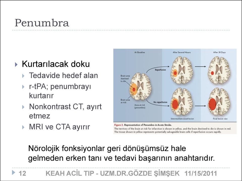 CTA ayırır Nörolojik fonksiyonlar geri dönüşümsüz hale