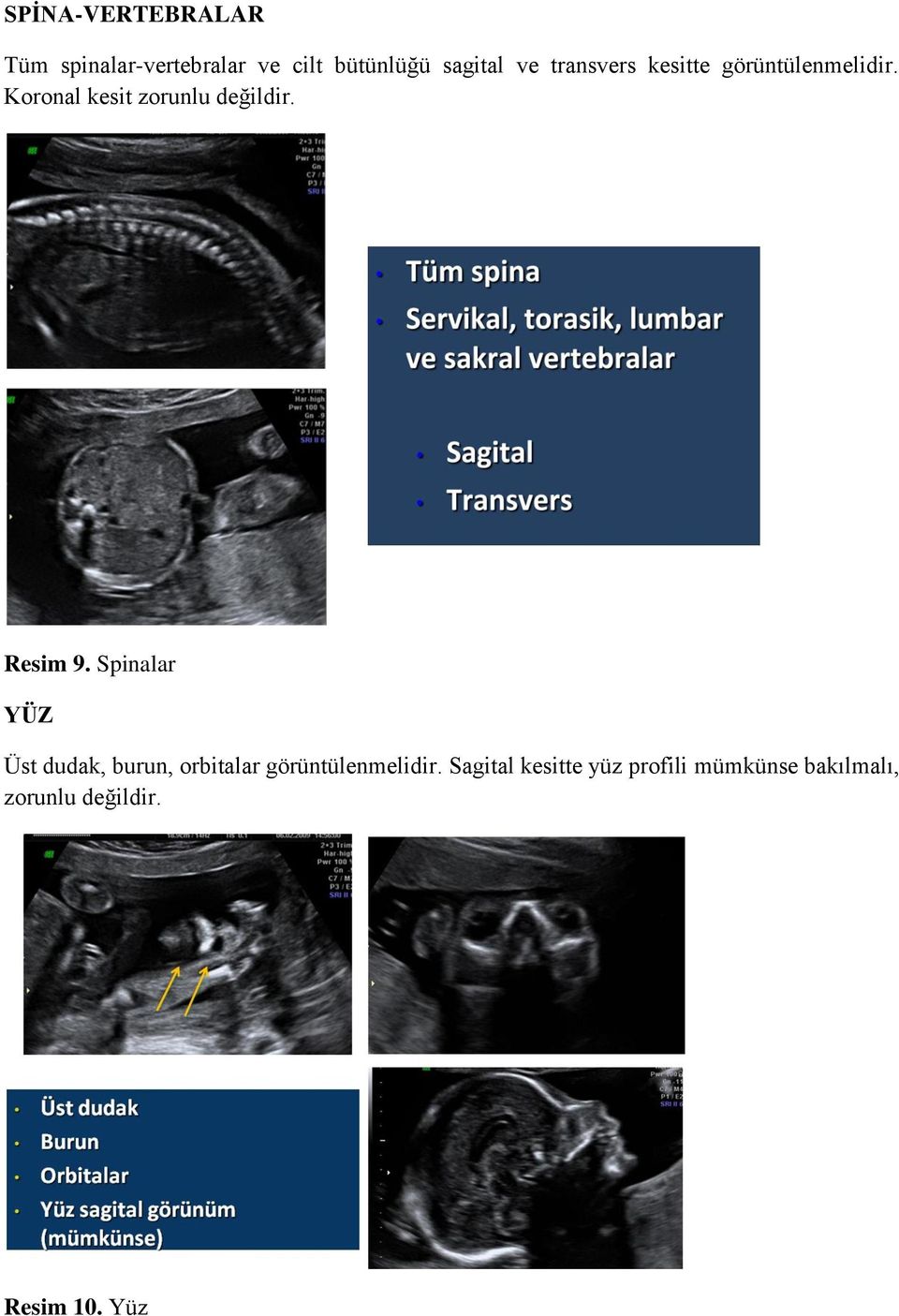 Resim 9. Spinalar YÜZ Üst dudak, burun, orbitalar görüntülenmelidir.