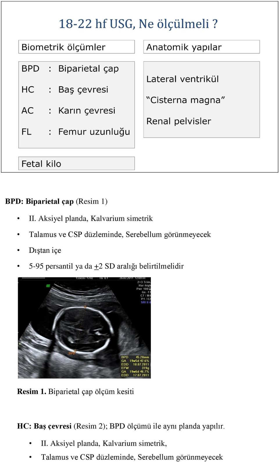 içe 5-95 persantil ya da +2 SD aralığı belirtilmelidir Resim 1.