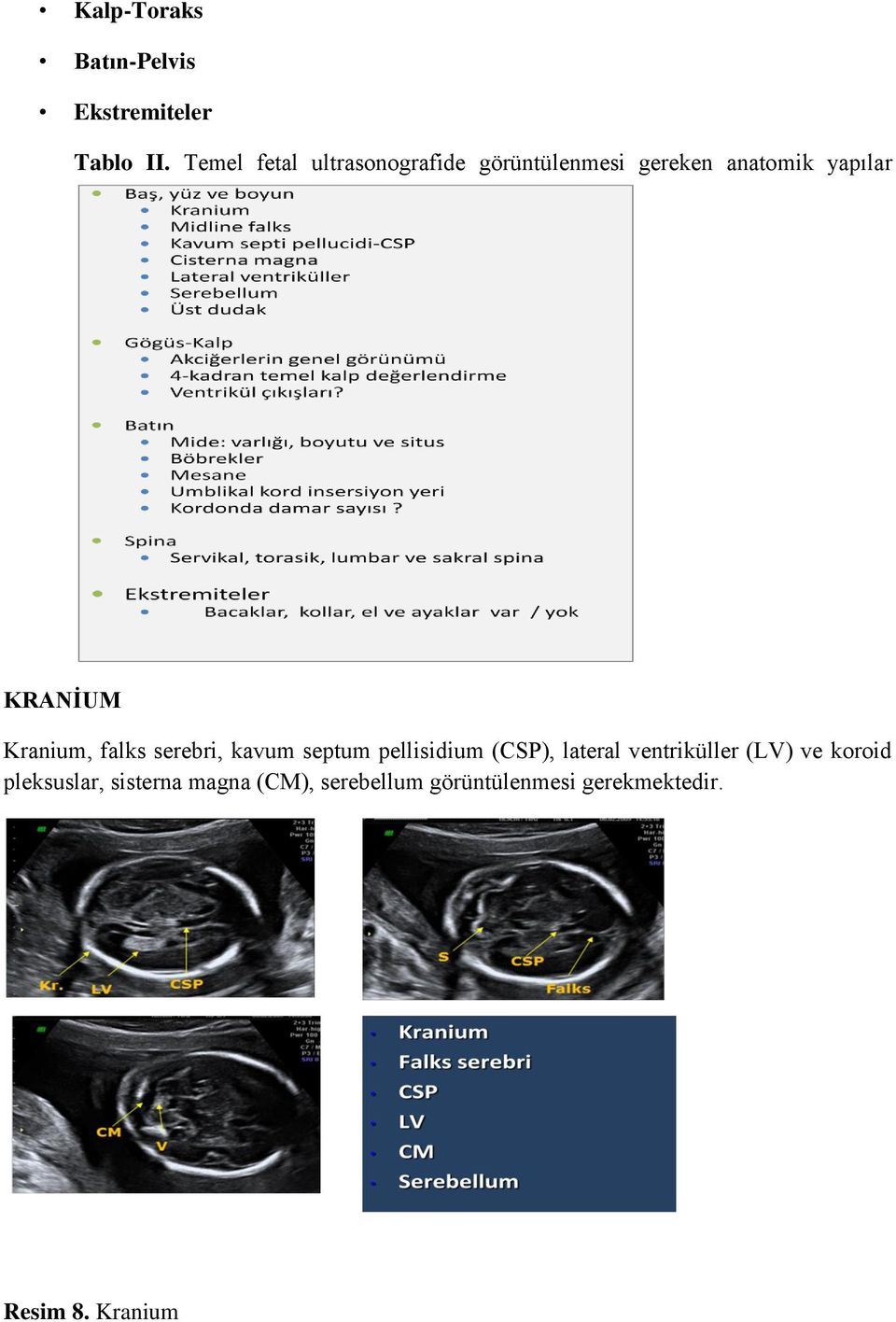 Kranium, falks serebri, kavum septum pellisidium (CSP), lateral ventriküller