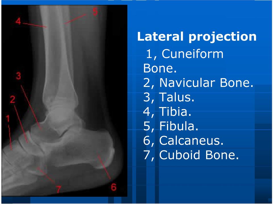 2, Navicular Bone. 3, Talus.