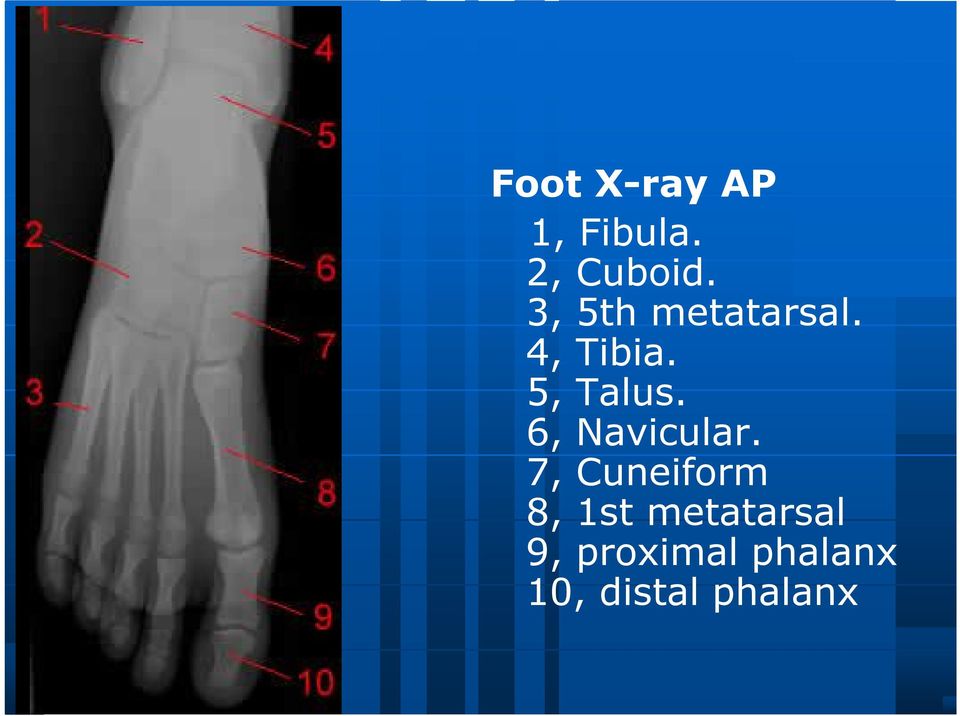 6, Navicular.