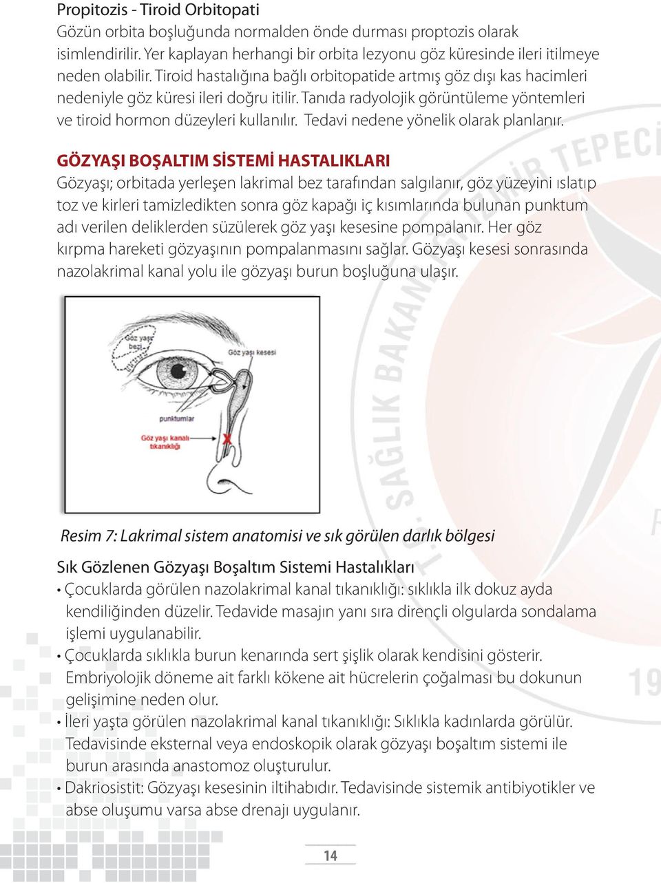 Tedavi nedene yönelik olarak planlanır.