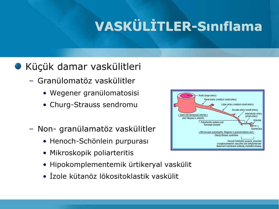 granülamatöz vaskülitler Henoch-Schönlein purpurası Mikroskopik