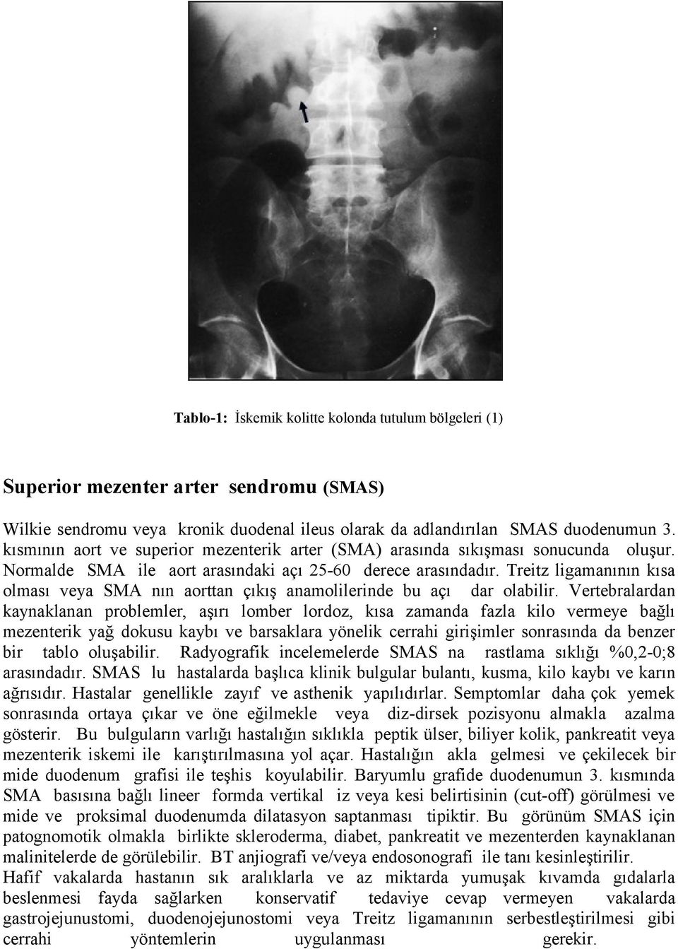 Treitz ligamanının kısa olması veya SMA nın aorttan çıkış anamolilerinde bu açı dar olabilir.