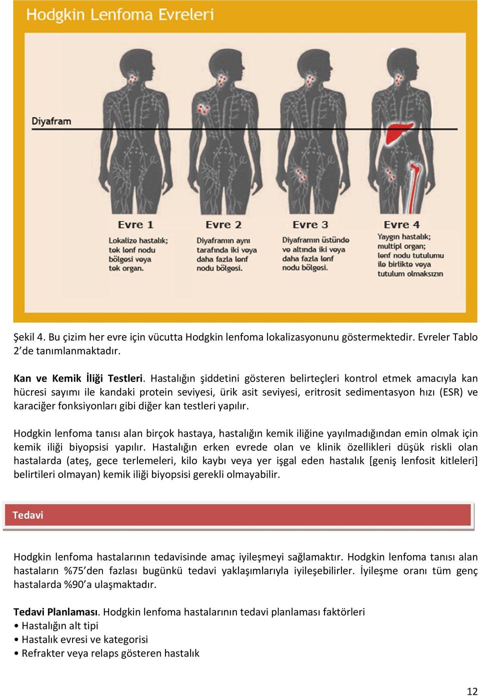 gibi diğer kan testleri yapılır. Hodgkin lenfoma tanısı alan birçok hastaya, hastalığın kemik iliğine yayılmadığından emin olmak için kemik iliği biyopsisi yapılır.