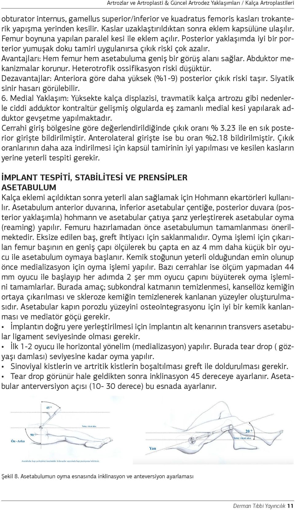 Avantajları: Hem femur hem asetabuluma geniş bir görüş alanı sağlar. Abduktor mekanizmalar korunur. Heterotrofik ossifikasyon riski düşüktür.