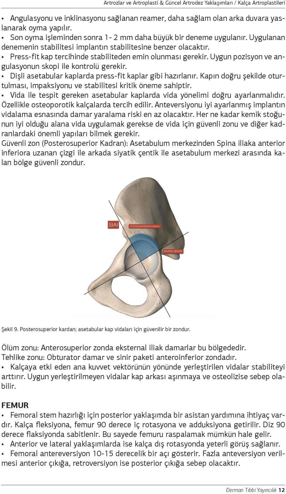 Dişli asetabular kaplarda press-fit kaplar gibi hazırlanır. Kapın doğru şekilde oturtulması, impaksiyonu ve stabilitesi kritik öneme sahiptir.