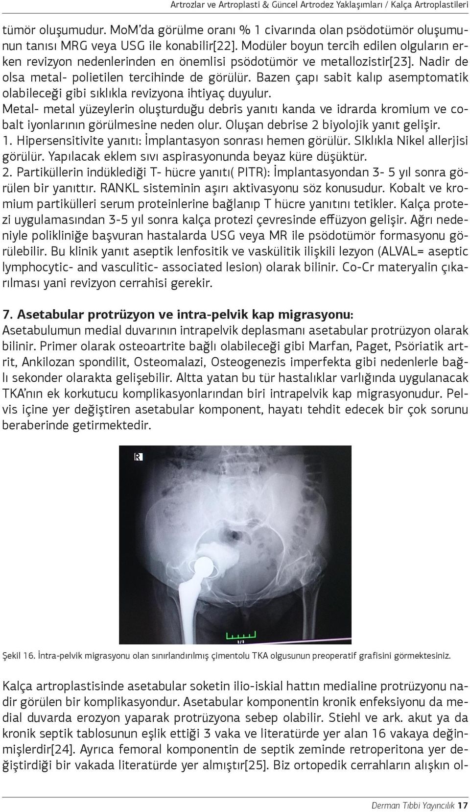 Bazen çapı sabit kalıp asemptomatik olabileceği gibi sıklıkla revizyona ihtiyaç duyulur.