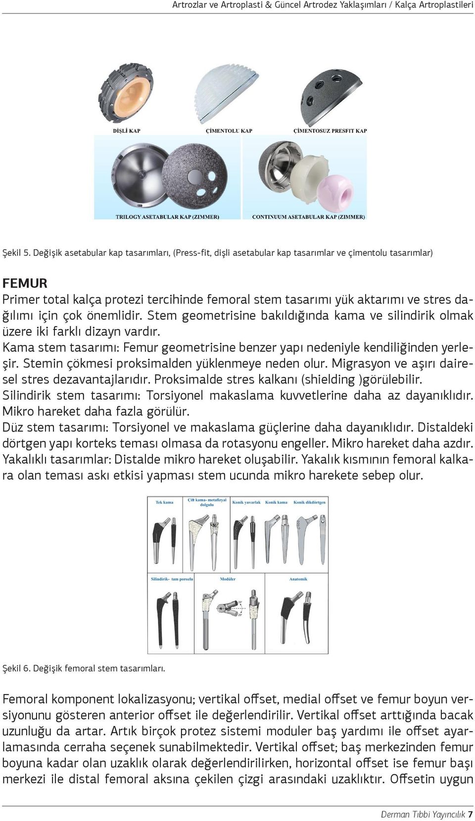 dağılımı için çok önemlidir. Stem geometrisine bakıldığında kama ve silindirik olmak üzere iki farklı dizayn vardır.