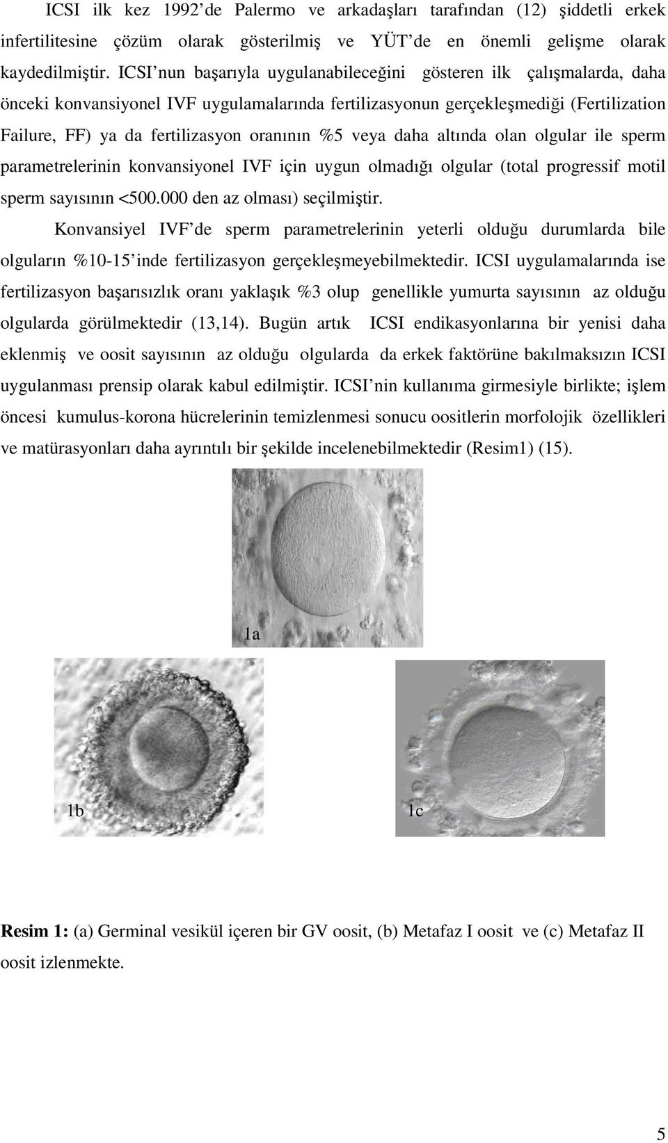 %5 veya daha altında olan olgular ile sperm parametrelerinin konvansiyonel IVF için uygun olmadığı olgular (total progressif motil sperm sayısının <500.000 den az olması) seçilmiştir.