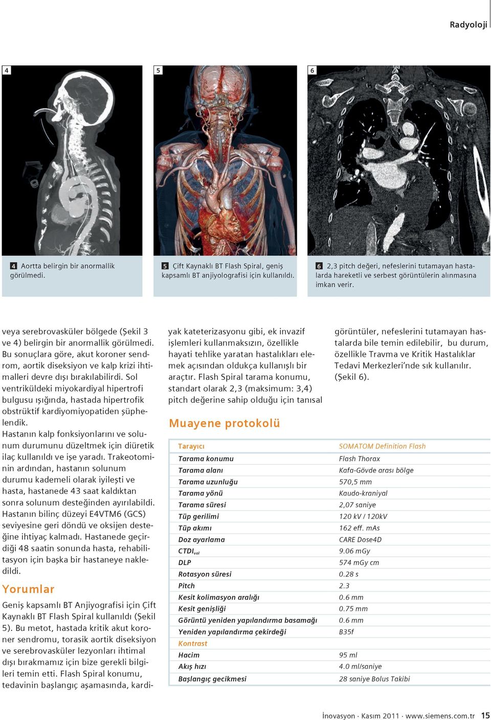 Bu sonuçlara göre, akut koroner sendrom, aortik diseksiyon ve kalp krizi ihtimalleri devre dışı bırakılabilirdi.