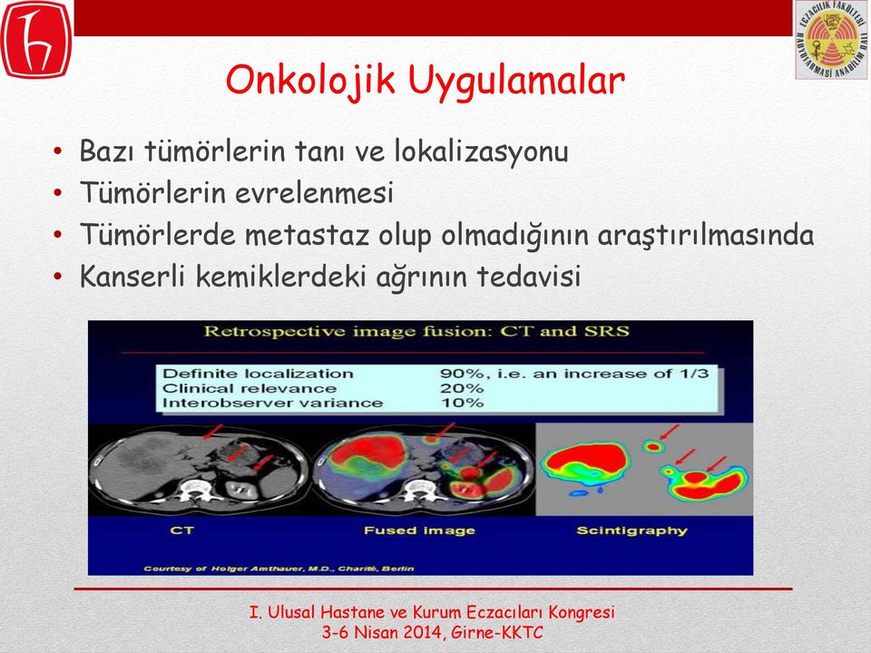 Tümörlerde metastaz olup olmadığının