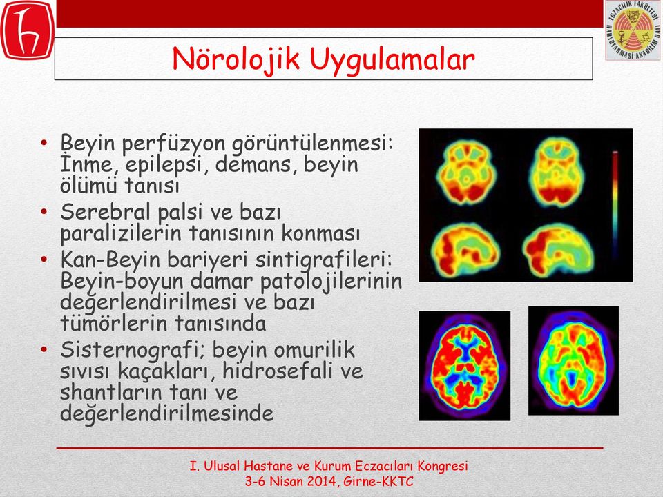 sintigrafileri: Beyin-boyun damar patolojilerinin değerlendirilmesi ve bazı tümörlerin