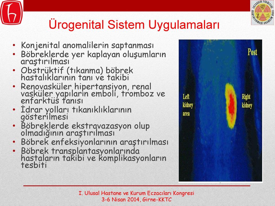 tromboz ve enfarktüs tanısı İdrar yolları tıkanıklıklarının gösterilmesi Böbreklerde ekstravazasyon olup olmadığının