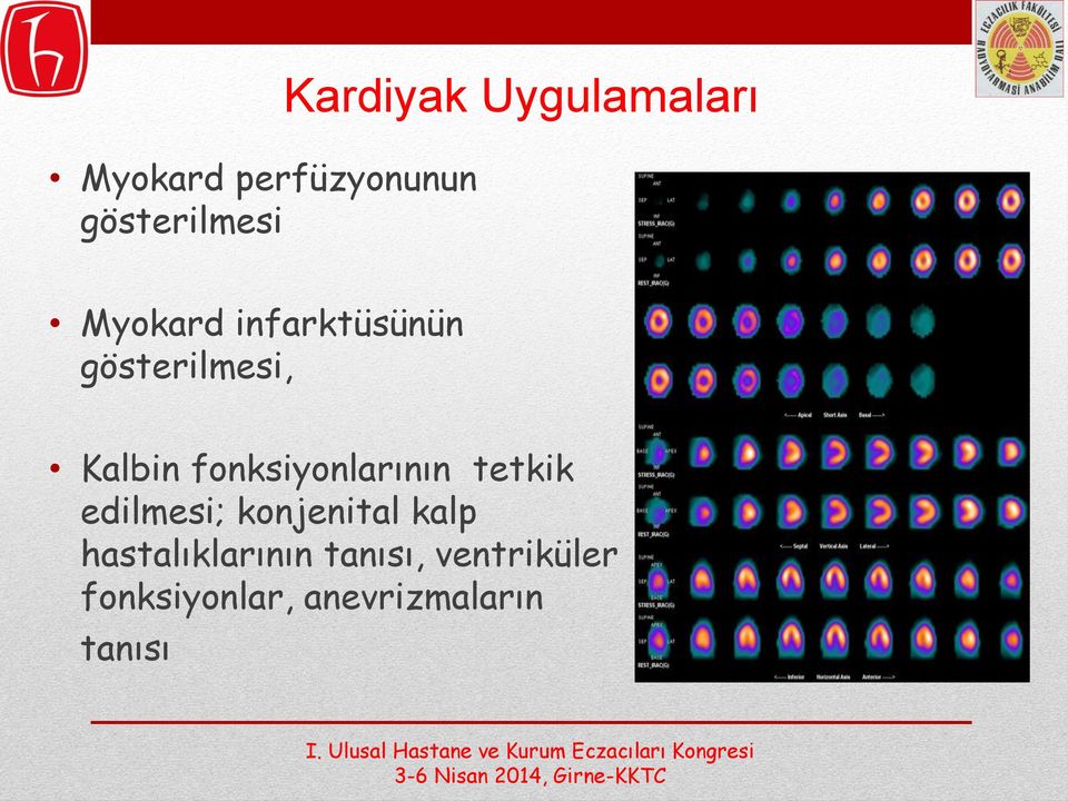 fonksiyonlarının tetkik edilmesi; konjenital kalp