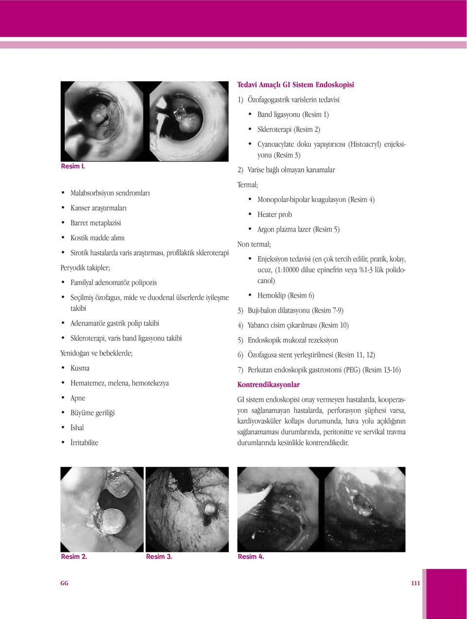 Seçilmiş özofagus, mide ve duodenal ülserlerde iyileşme takibi Adenamatöz gastrik polip takibi Skleroterapi, varis band ligasyonu takibi Yenidoğan ve bebeklerde; Kusma Hematemez, melena, hemotekezya