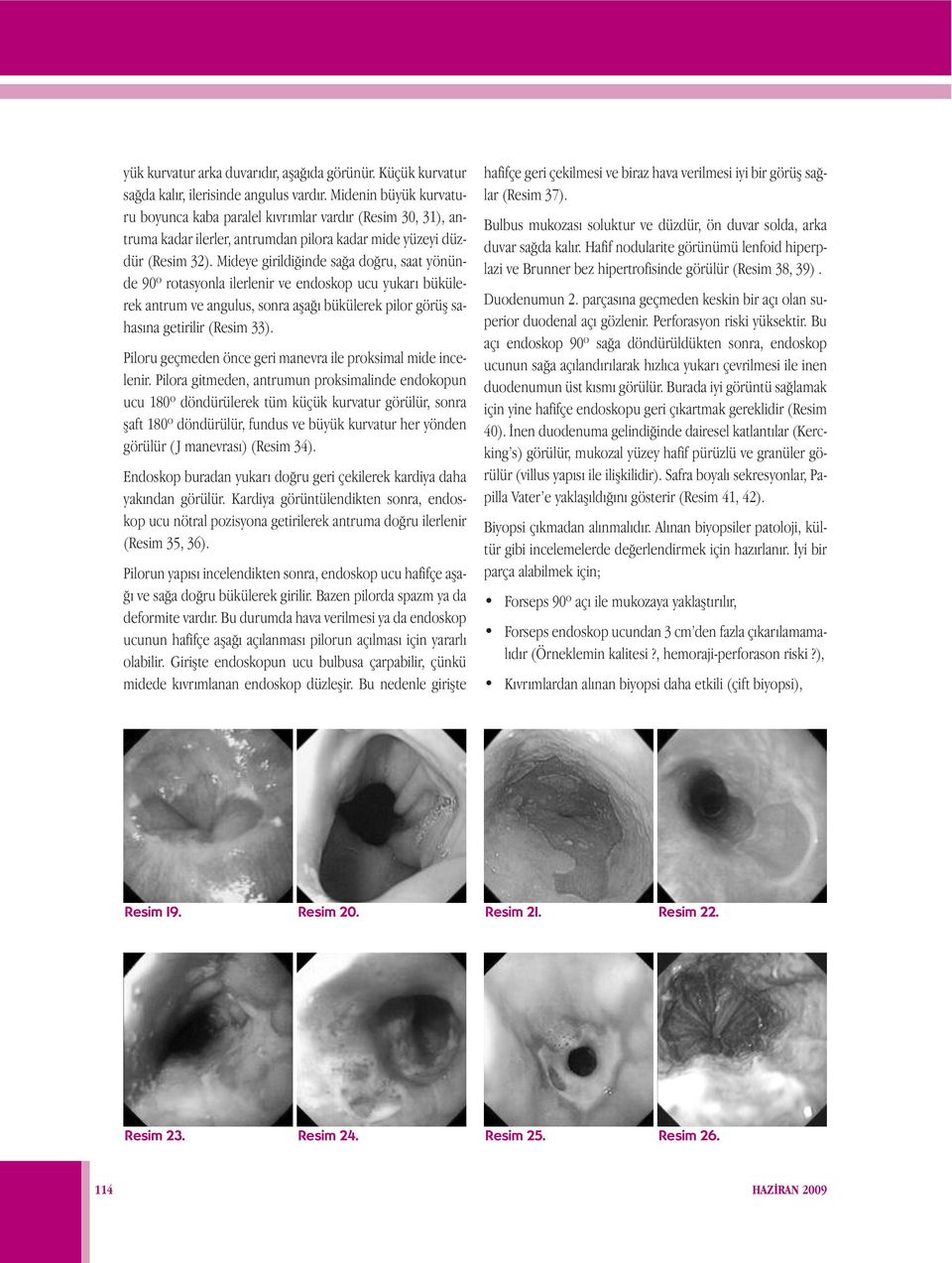 Mideye girildiğinde sağa doğru, saat yönünde 90º rotasyonla ilerlenir ve endoskop ucu yukarı bükülerek antrum ve angulus, sonra aşağı bükülerek pilor görüş sahasına getirilir (Resim 33).