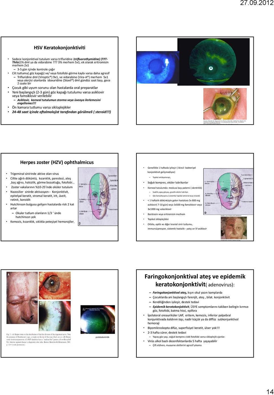 vidarabine (Vira A ) merhem 5x1 veya alerjisi olanlarda idoxuridine (Stoxil ) dml gündüz saat başı, gece 2 saate bir Çocuk gibi uyum sorunu olan hastalarda oral preparatlar Yeni başlangıçlı (2 3 gün)