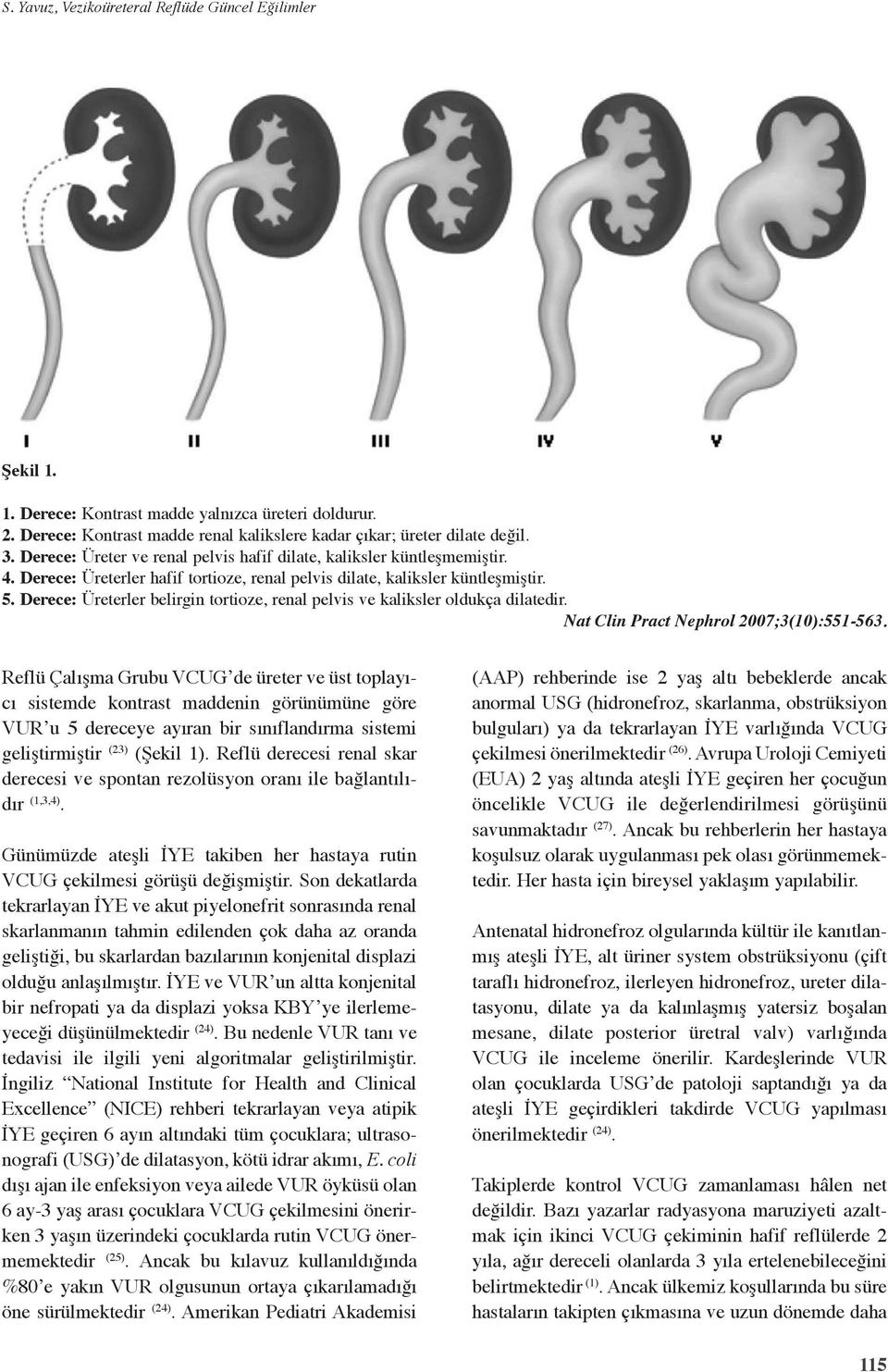 Derece: Üreterler belirgin tortioze, renal pelvis ve kaliksler oldukça dilatedir. Nat Clin Pract Nephrol 2007;3(10):551-563.