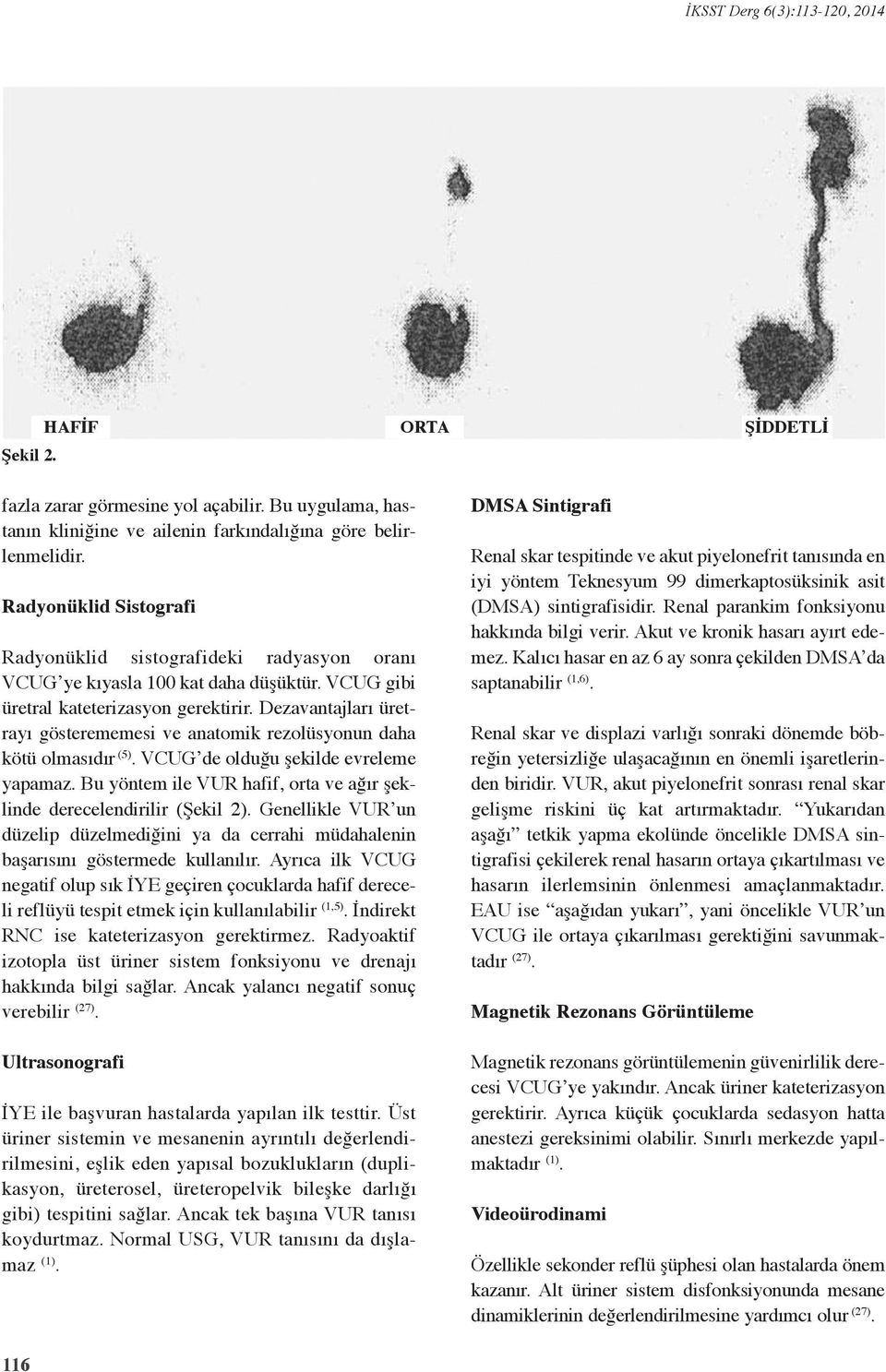 Dezavantajları üretrayı gösterememesi ve anatomik rezolüsyonun daha kötü olmasıdır (5). VCUG de olduğu şekilde evreleme yapamaz.