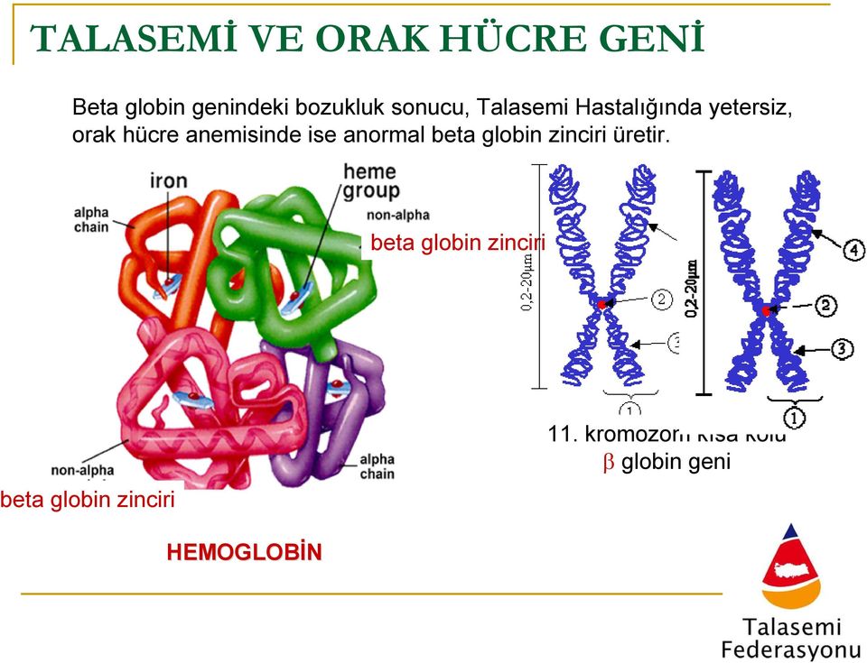 ise anormal beta globin zinciri üretir.