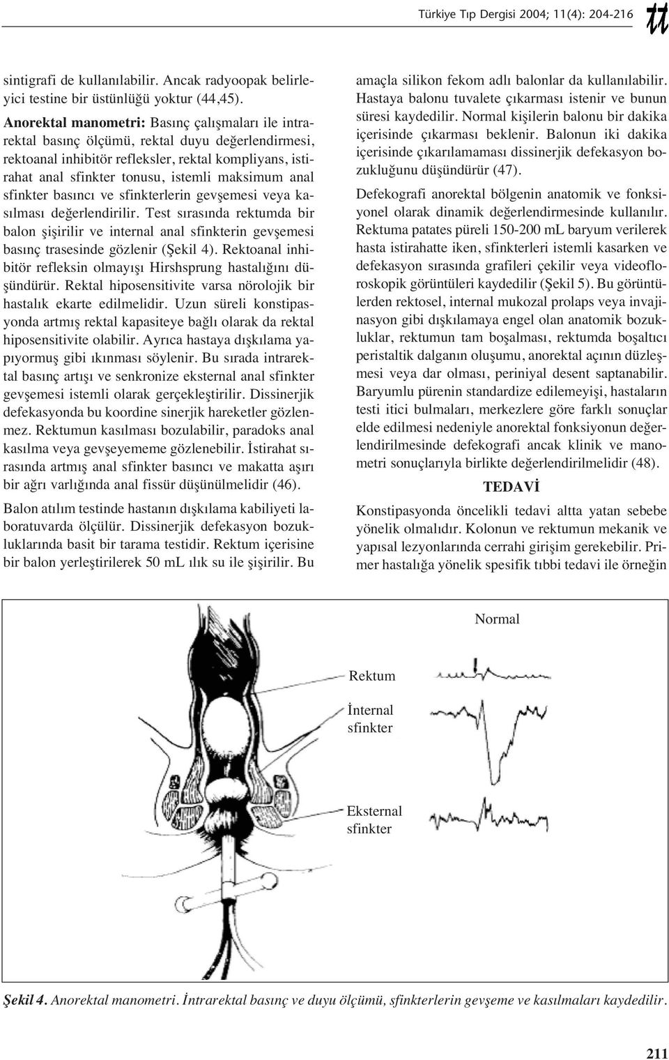 anal sfinkter bas nc ve sfinkterlerin gevşemesi veya kas lmas değerlendirilir. Test s ras nda rektumda bir balon şişirilir ve internal anal sfinkterin gevşemesi bas nç trasesinde gözlenir (Şekil 4).