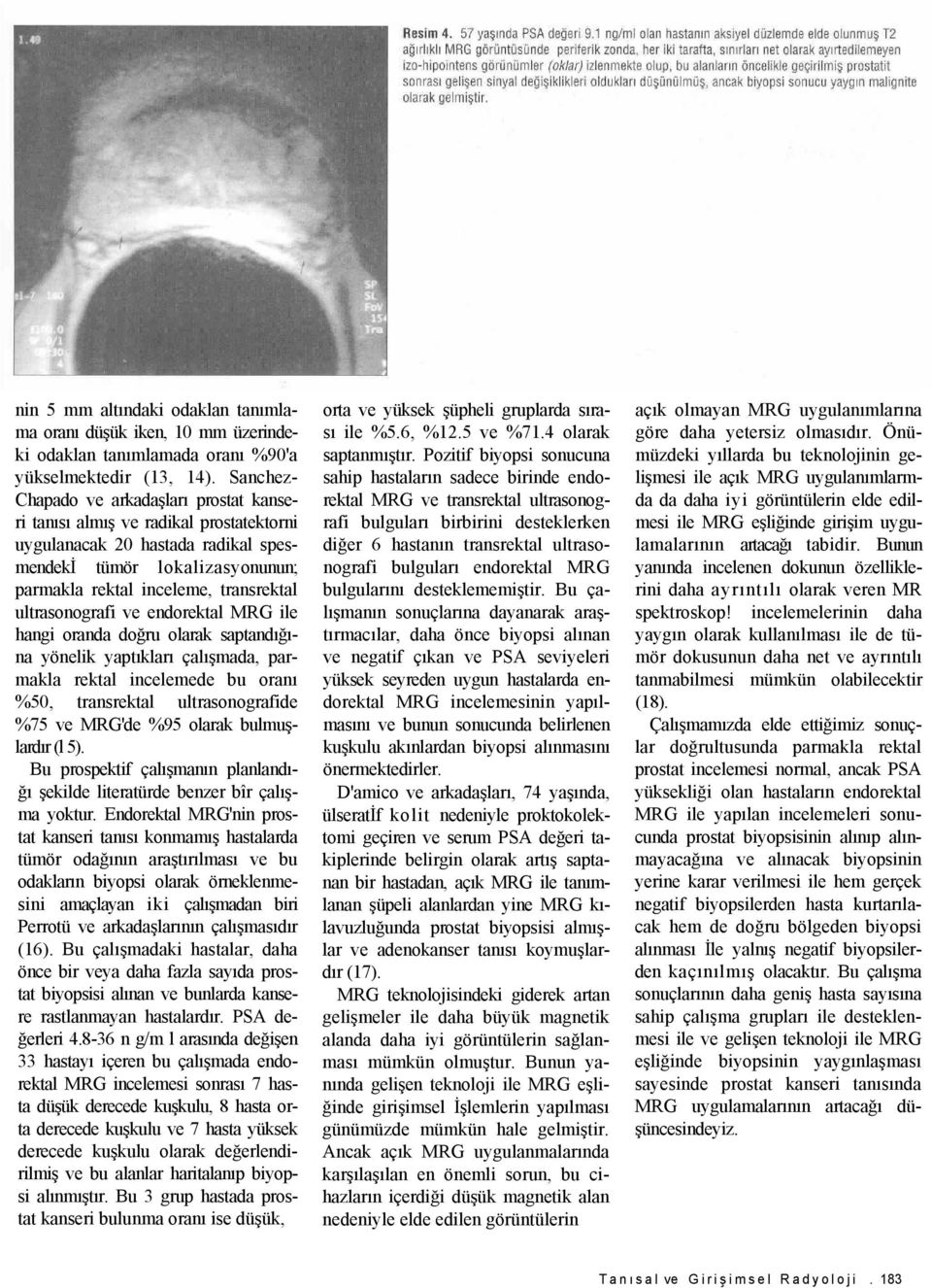 ultrasonografi ve endorektal MRG ile hangi oranda doğru olarak saptandığına yönelik yaptıkları çalışmada, parmakla rektal incelemede bu oranı %50, transrektal ultrasonografide %75 ve MRG'de %95