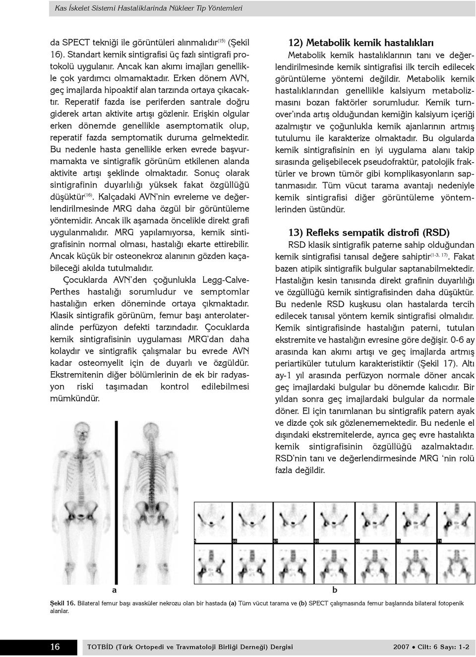 Reperatif fazda ise periferden santrale doðru giderek artan aktivite artýþý gözlenir. Eriþkin olgular erken dönemde genellikle asemptomatik olup, reperatif fazda semptomatik duruma gelmektedir.