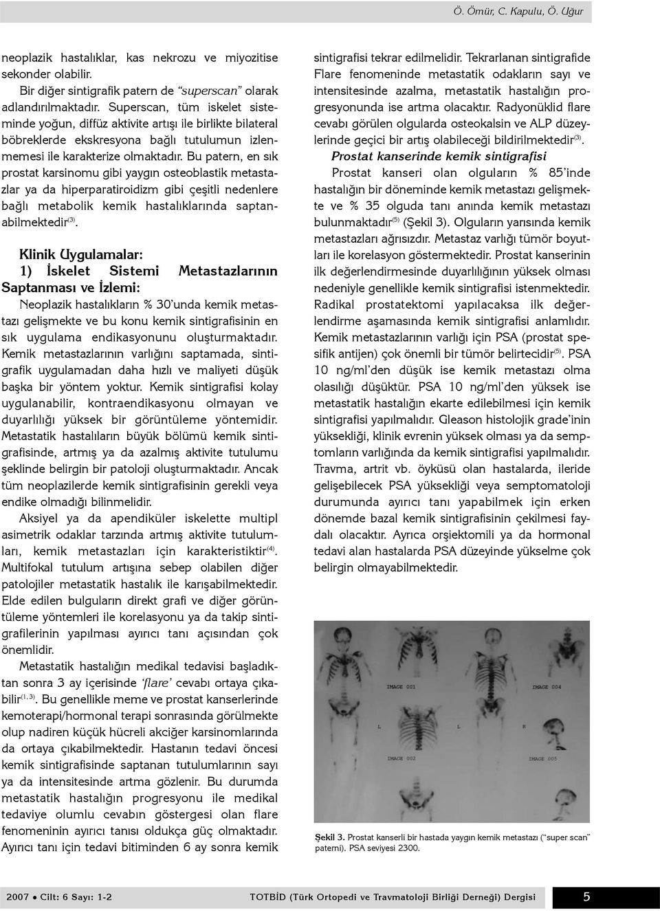 Bu patern, en sýk prostat karsinomu gibi yaygýn osteoblastik metastazlar ya da hiperparatiroidizm gibi çeþitli nedenlere baðlý metabolik kemik hastalýklarýnda saptanabilmektedir (3).