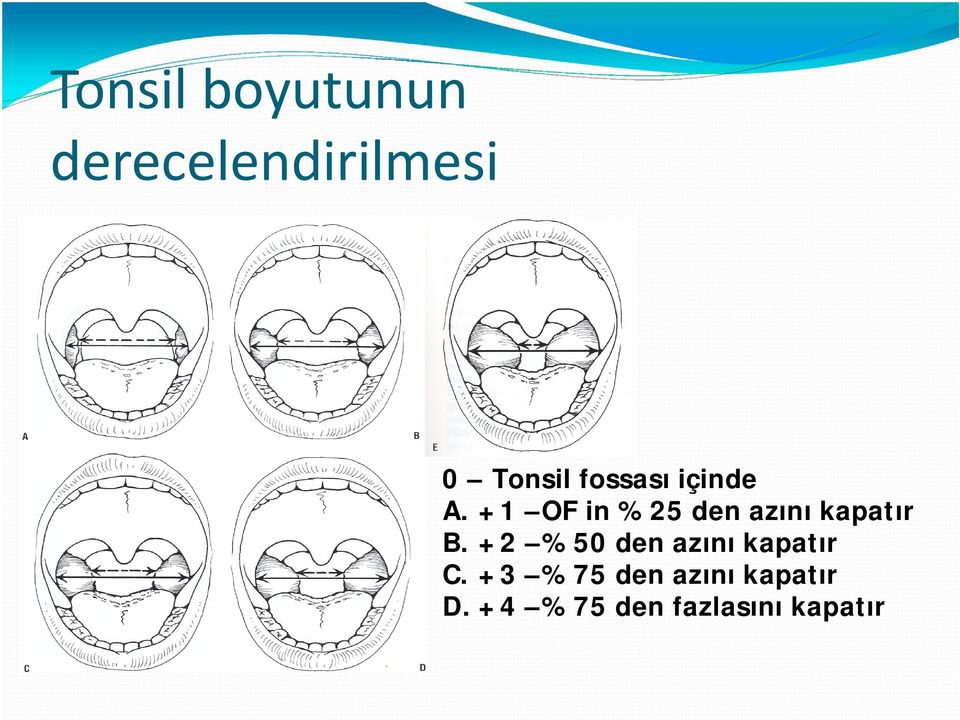 +1 OF in %25 den azını kapatır B.