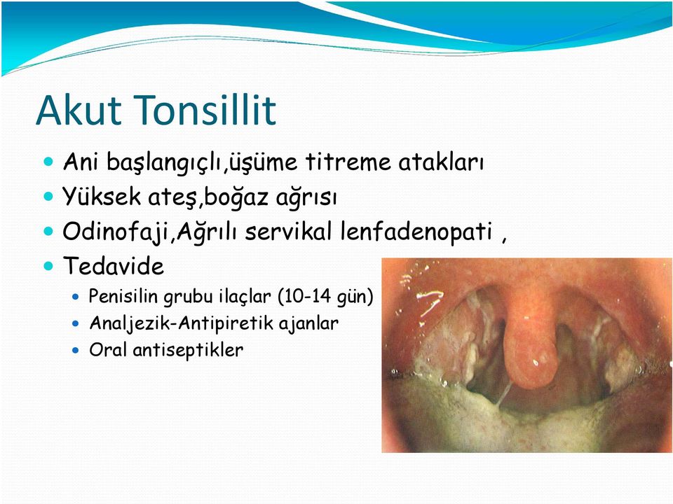 lenfadenopati, Tedavide Penisilin grubu ilaçlar