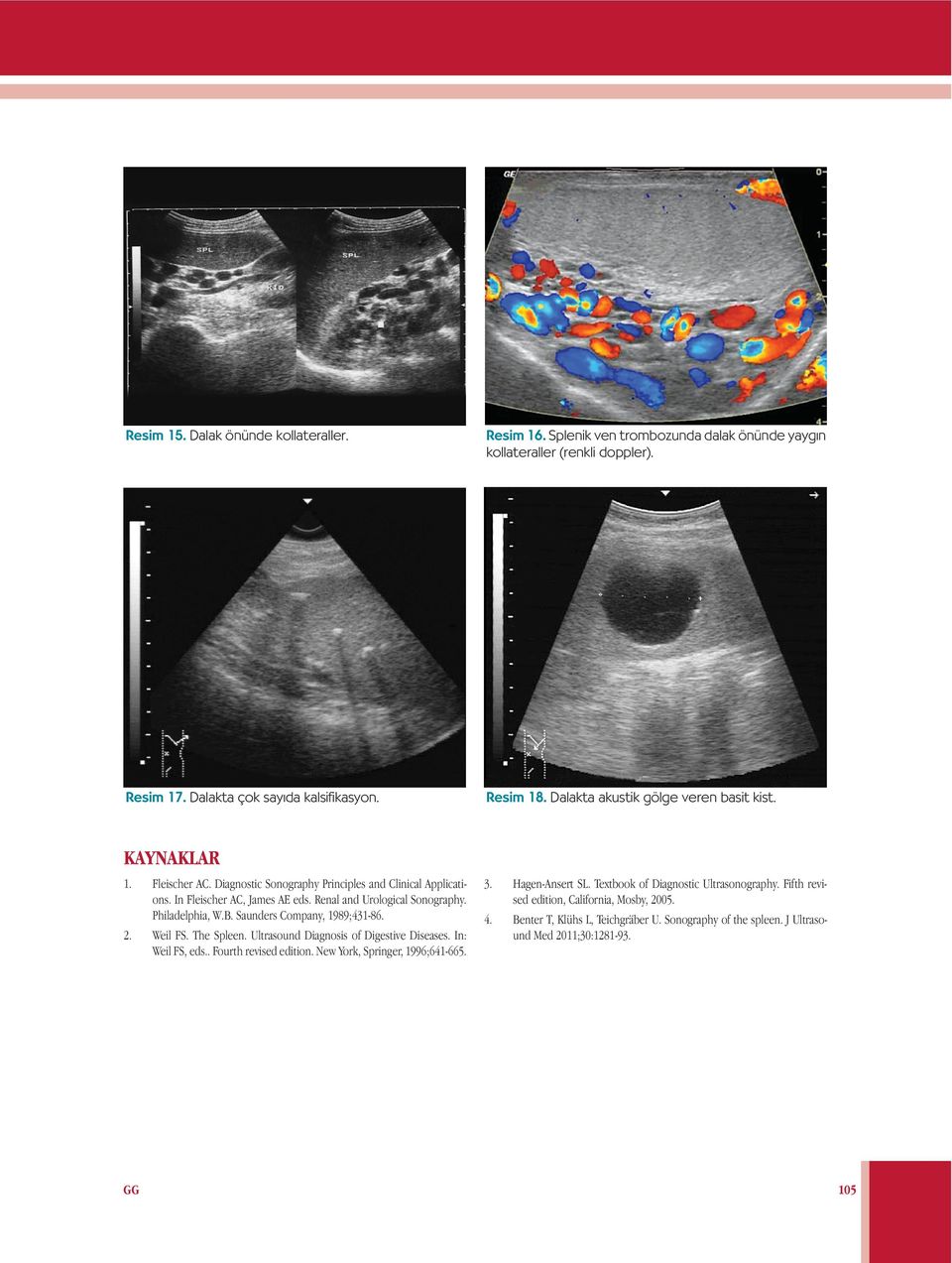 Philadelphia, W.B. Saunders Company, 1989;431-86. 2. Weil FS. The Spleen. Ultrasound Diagnosis of Digestive Diseases. In: Weil FS, eds.. Fourth revised edition. New York, Springer, 1996;641-665.