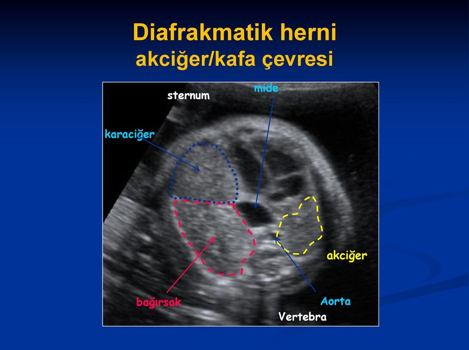 sternum mide karaciğer