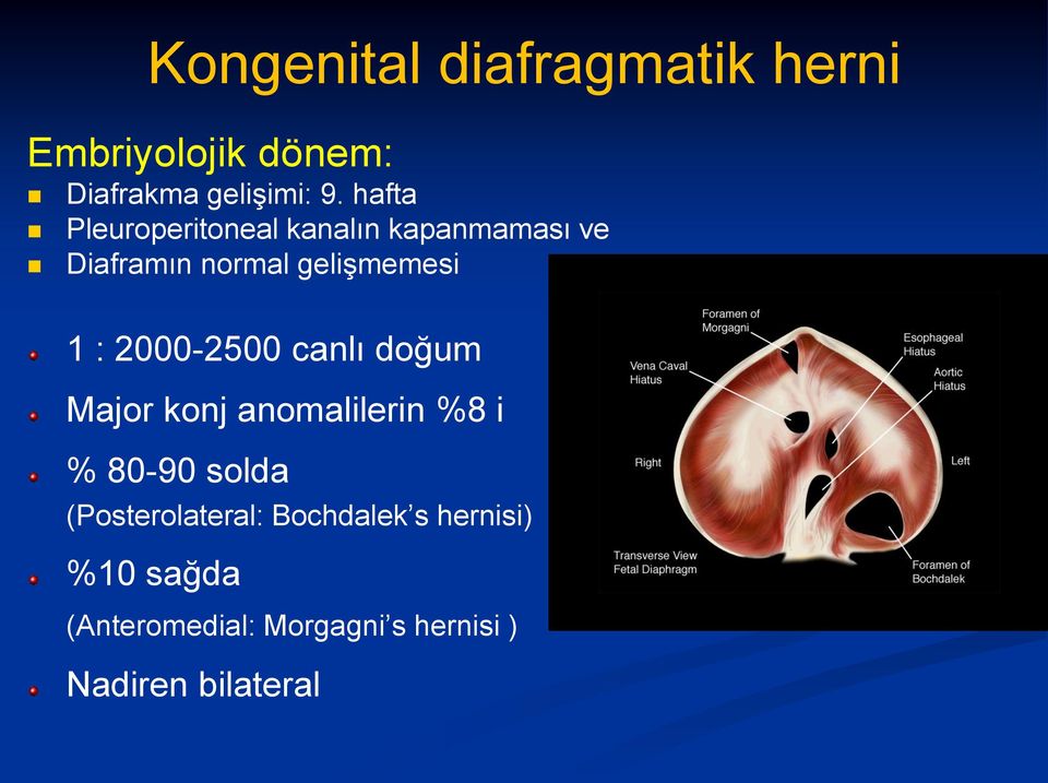 2000-2500 canlı doğum Major konj anomalilerin %8 i % 80-90 solda