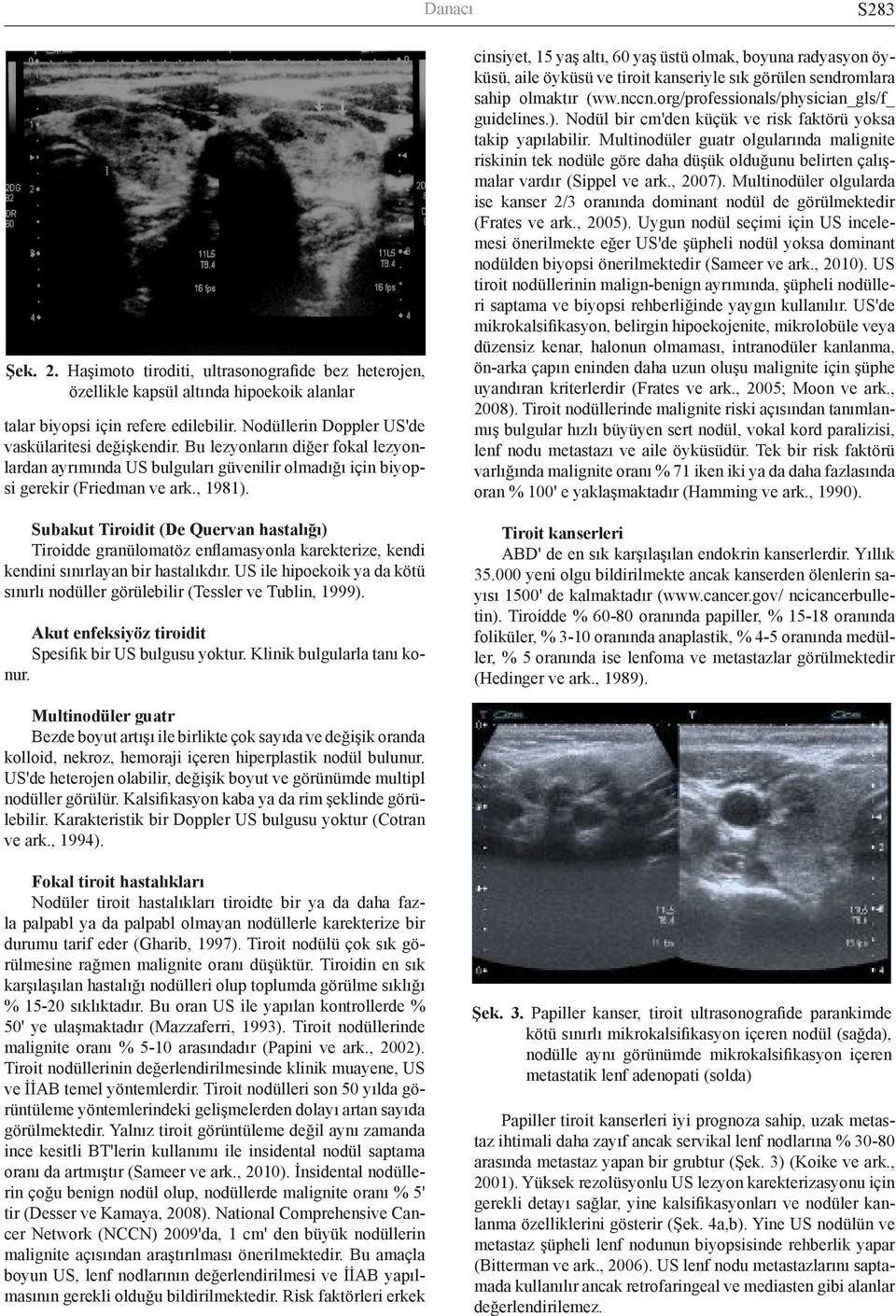 Subakut Tiroidit (De Quervan hastalığı) Tiroidde granülomatöz enflamasyonla karekterize, kendi kendini sınırlayan bir hastalıkdır.