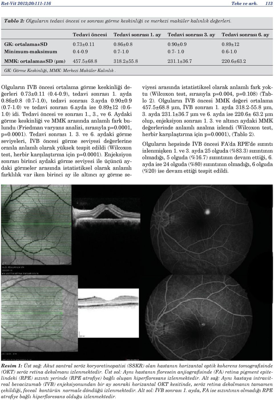 2 GK: Görme Keskinliği, MMK: Merkezi Maküler Kalınlık. Olguların IVB öncesi ortalama görme keskinliği değerleri 0.73±0.11 (0.4-0.9), tedavi sonrası 1. ayda 0.86±0.8 (0.7-1.0), tedavi sonrası 3.ayda 0.90±0.