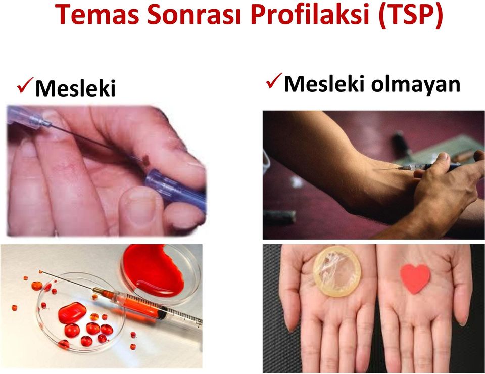 (TSP) Mesleki