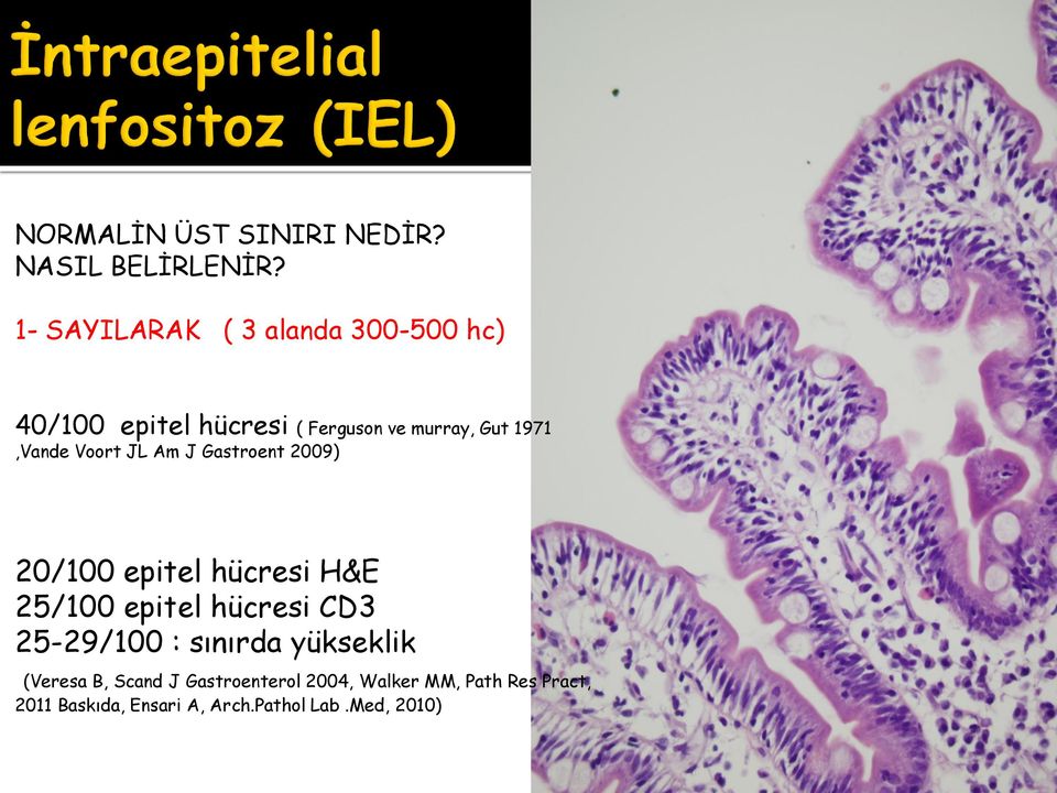 1971,Vande Voort JL Am J Gastroent 2009) 20/100 epitel hücresi H&E 25/100 epitel hücresi