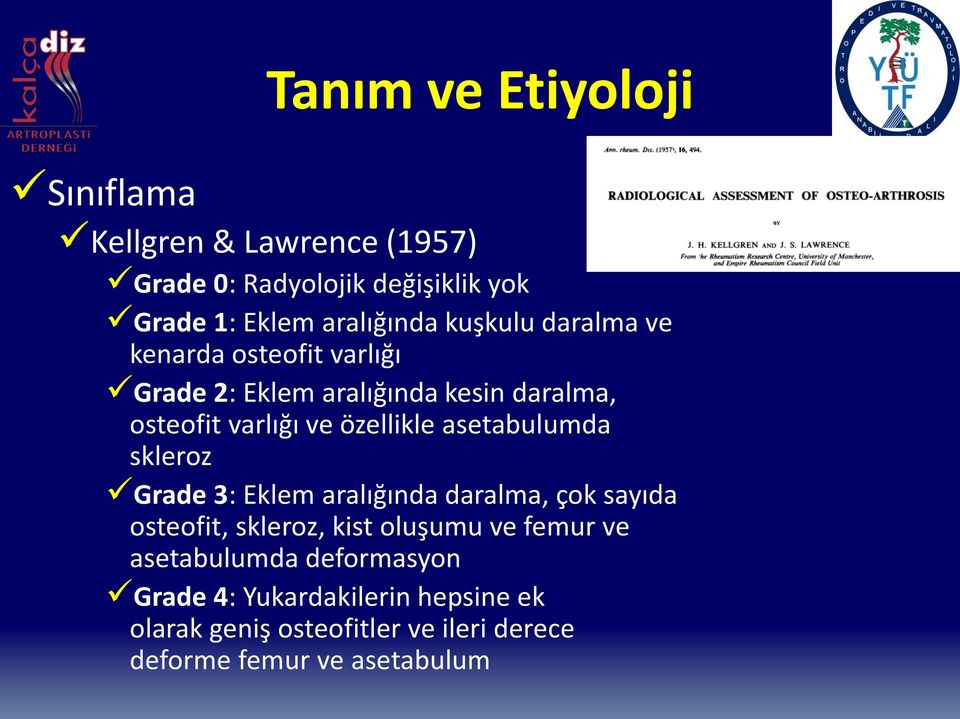 asetabulumda skleroz Grade 3: Eklem aralığında daralma, çok sayıda osteofit, skleroz, kist oluşumu ve femur ve