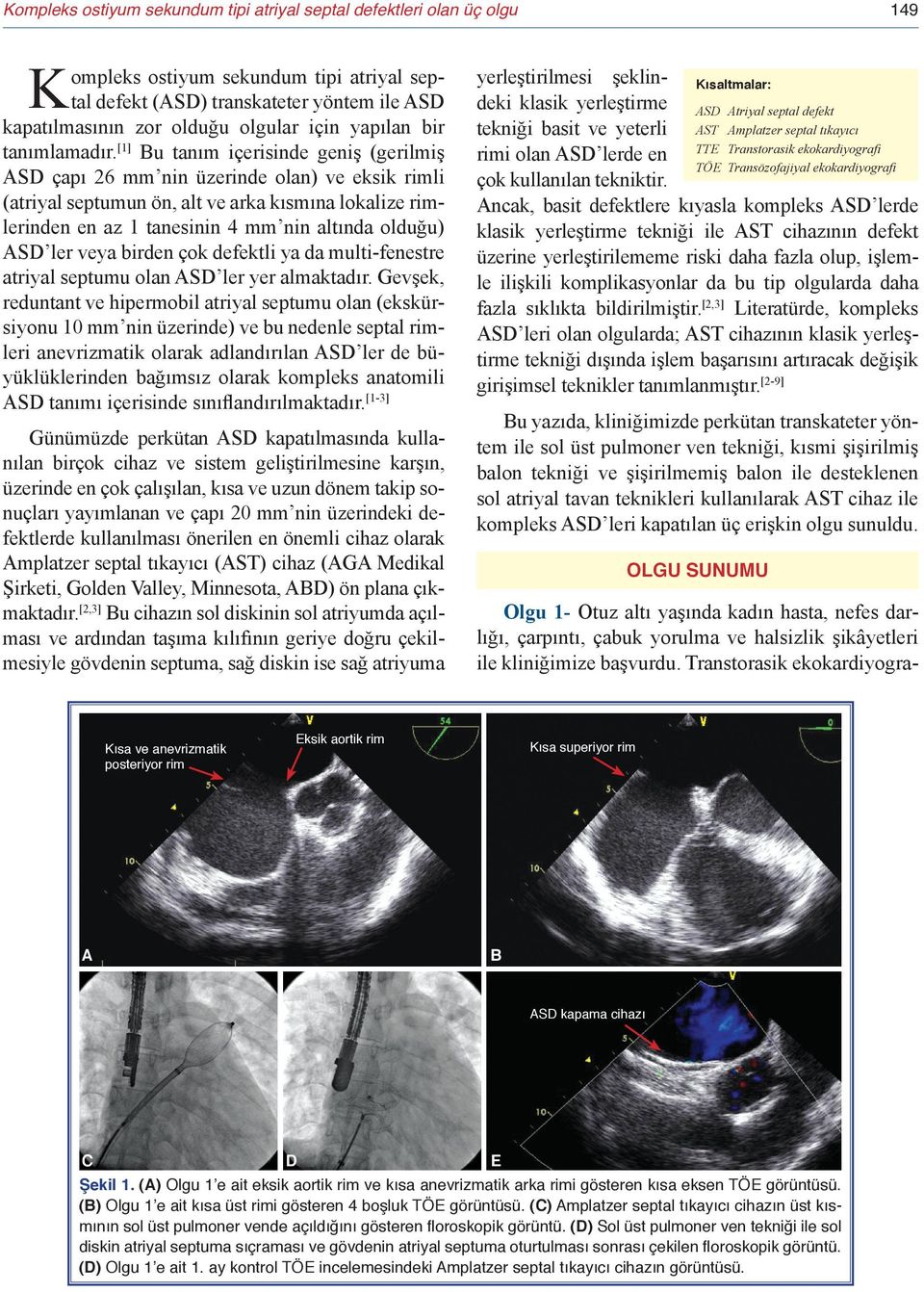 [1] Bu tanım içerisinde geniş (gerilmiş ASD çapı 26 mm nin üzerinde olan) ve eksik rimli (atriyal septumun ön, alt ve arka kısmına lokalize rimlerinden en az 1 tanesinin 4 mm nin altında olduğu) ASD