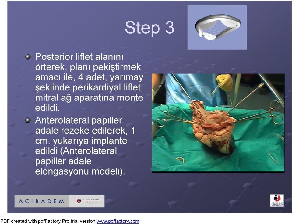 monte edildi. Anterolateral papiller adale rezeke edilerek, 1 cm.