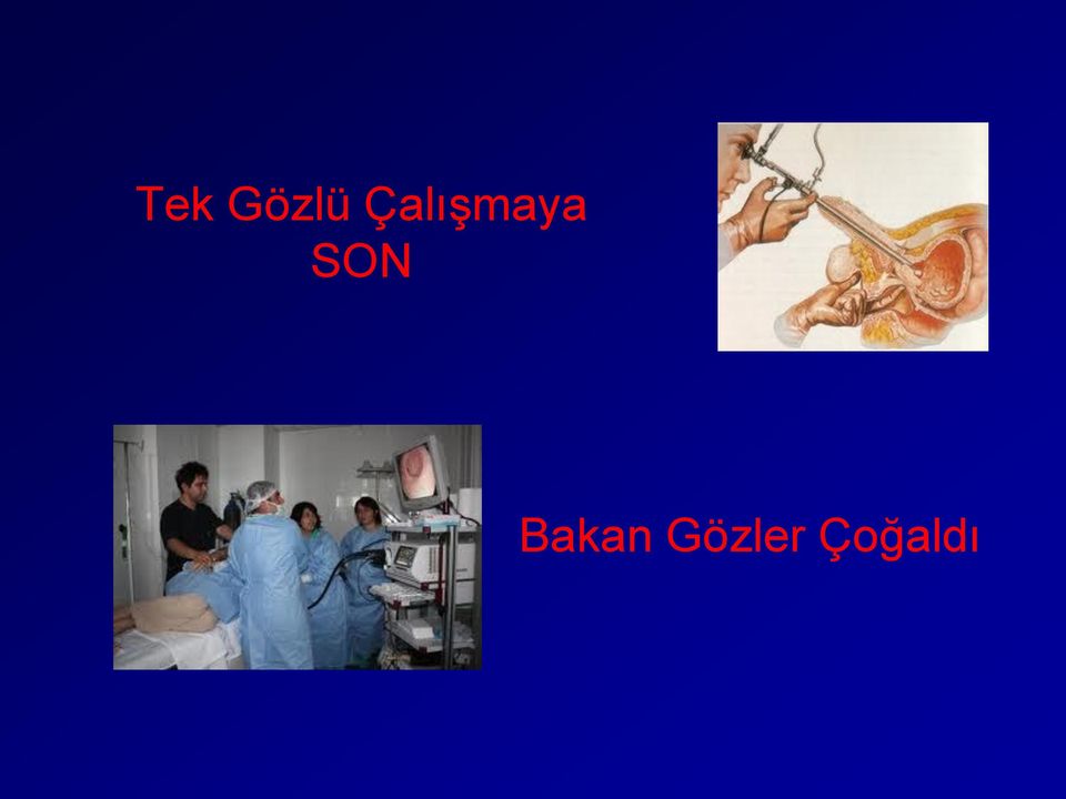 SON Bakan