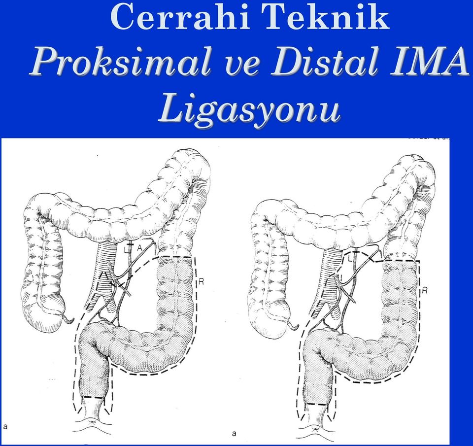 Proksimal