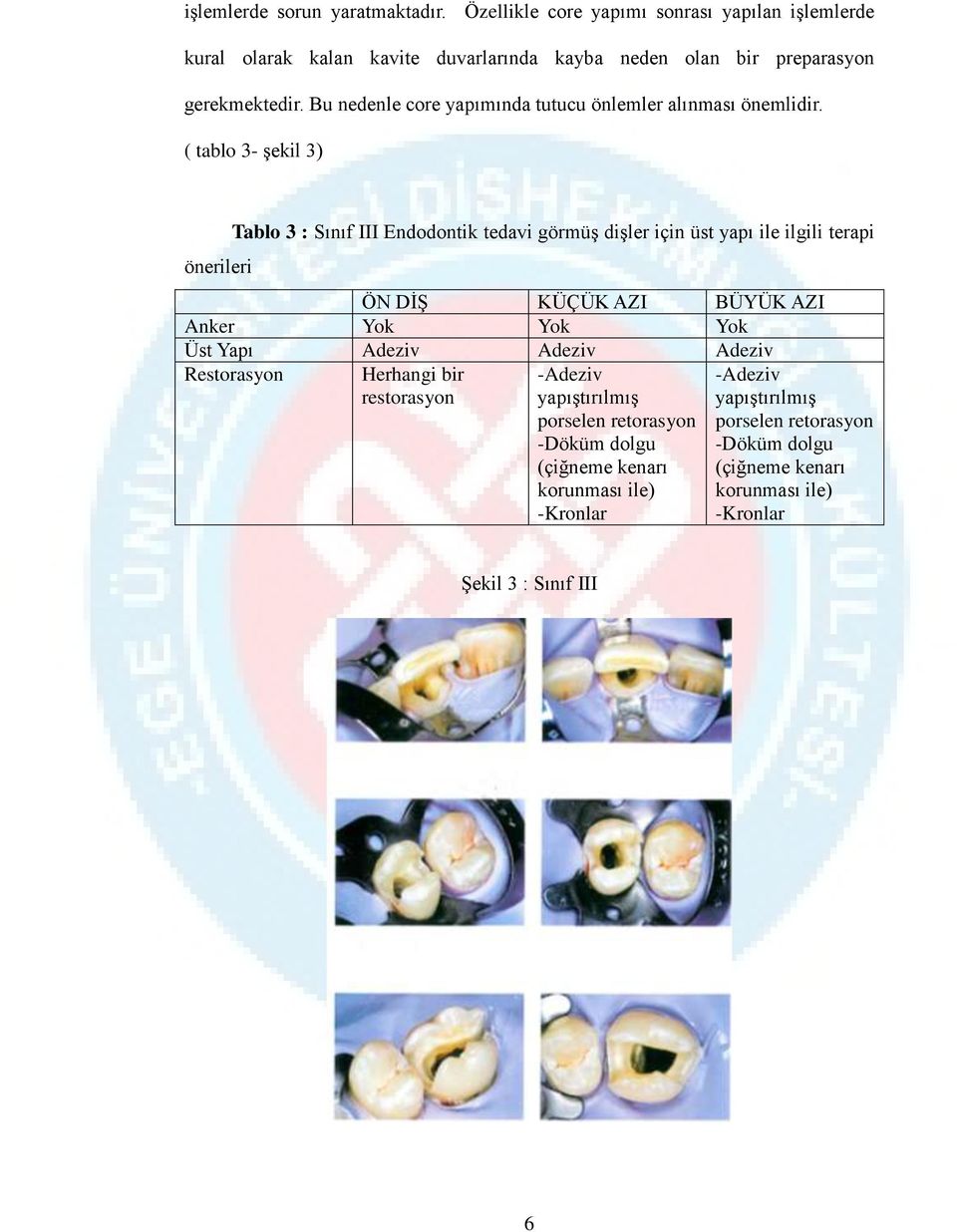 ( tablo 3- şekil 3) önerileri Tablo 3 : Sınıf III Endodontik tedavi görmüş dişler için üst yapı ile ilgili terapi ÖN DİŞ KÜÇÜK AZI BÜYÜK AZI Anker Yok Yok Yok Üst