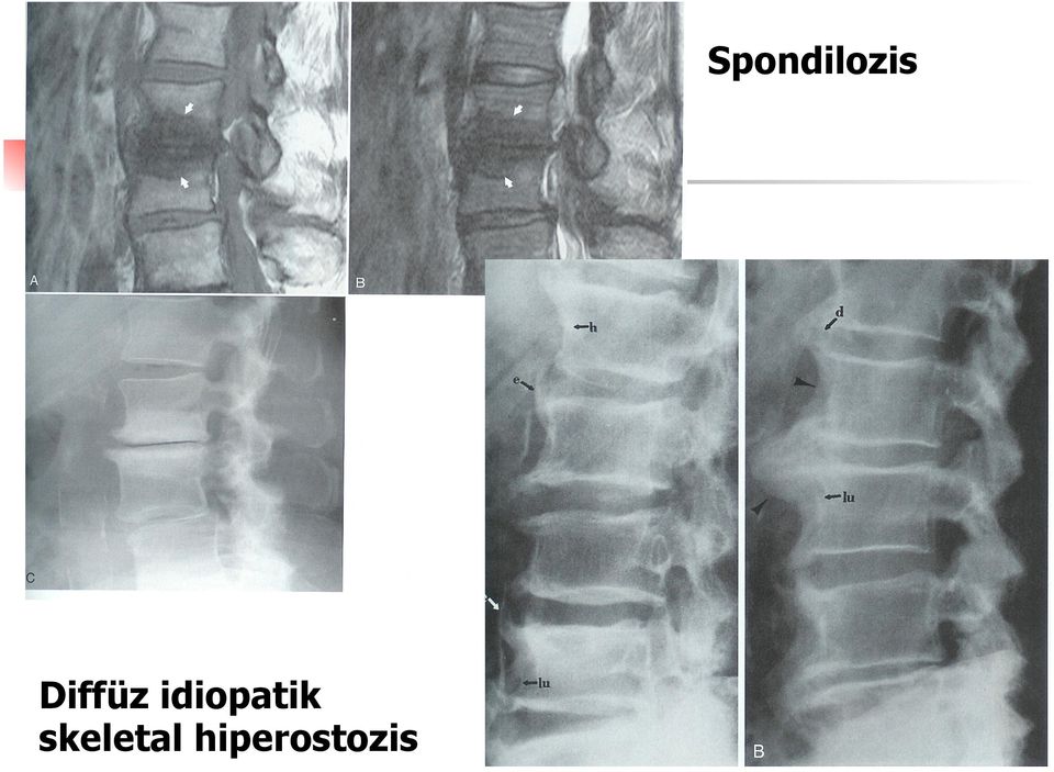 idiopatik