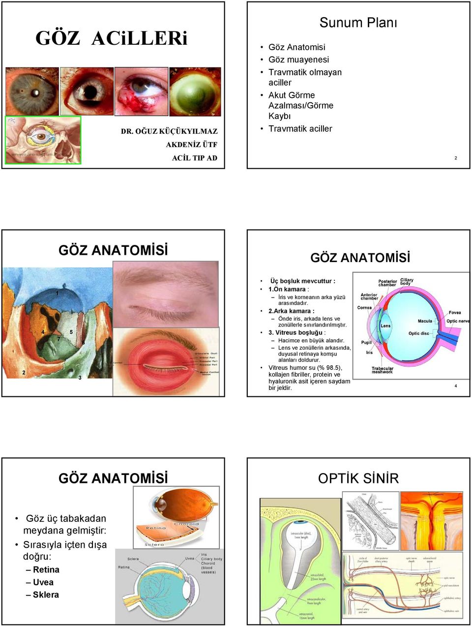 GÖZ ANATOMİSİ 2 1 4 5 7 3 6 Üç boşluk mevcuttur : 1.Ön kamara : İris ve korneanın arka yüzü arasındadır. 2.Arka kamara : Önde iris, arkada lens ve zonüllerle sınırlandırılmıştır.